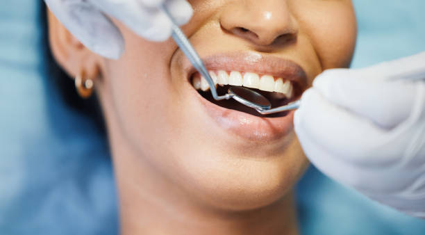 Best Teeth Whitening  in Salyersville, KY
